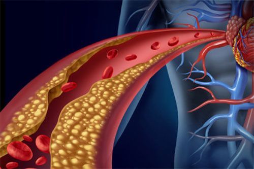 Laboratorio Análisis Clínicos - Perfil Lipídico Colesterol Triglicéridos - NovaLab