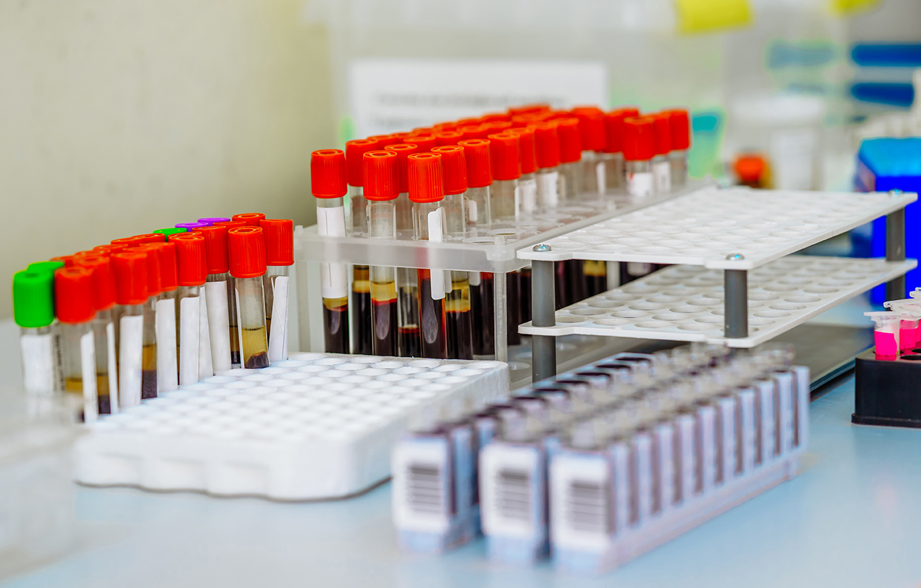 Laboratorio Análisis Clínicos NovaLab